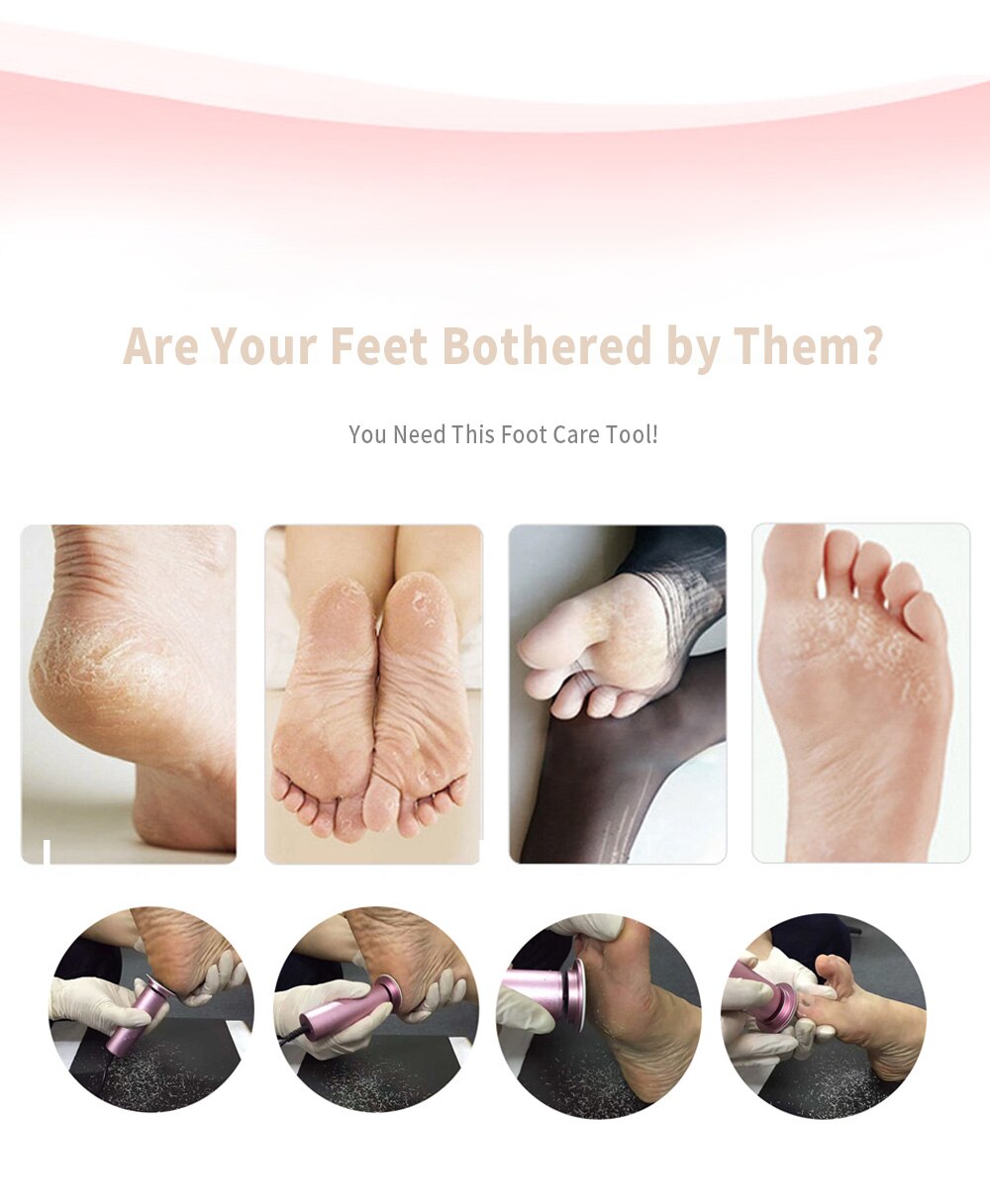 Effective Foot Callus Shaver Tool