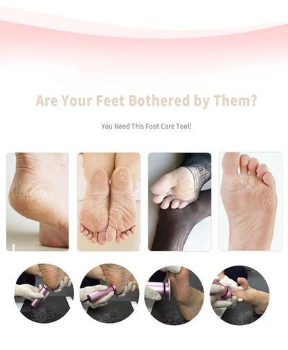 Effective Foot Callus Shaver Tool