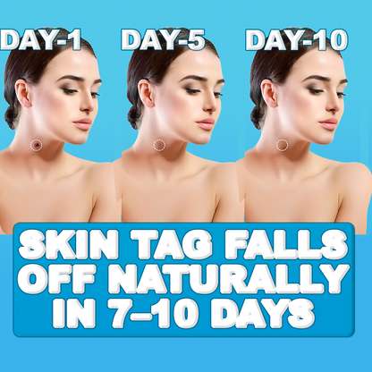 Easy At-Home Skin Tag and Mole Remover Pen