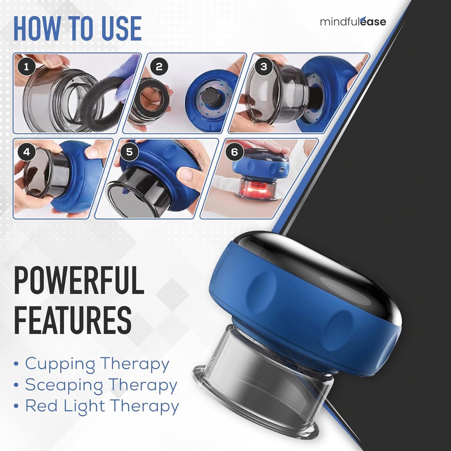Professional Vacuum Cupping Device