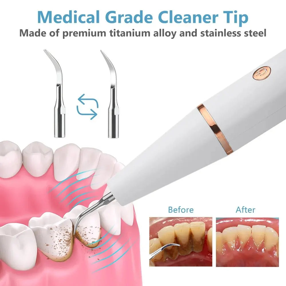 Professional Dental Plaque Remover with LED Light