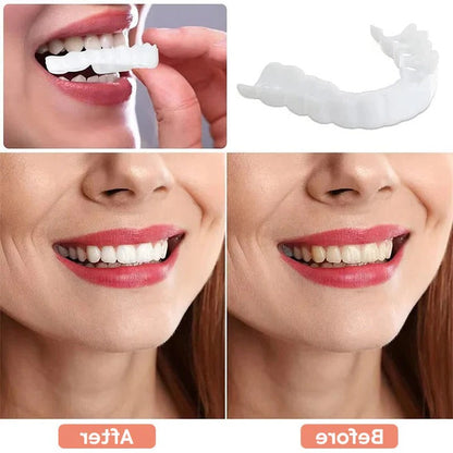 Realistic White Dental Veneers