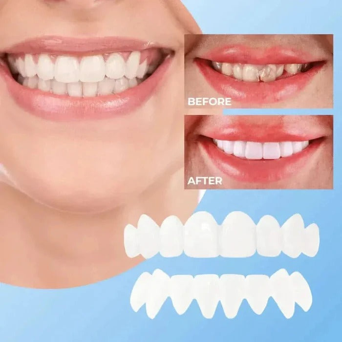 Realistic White Dental Veneers