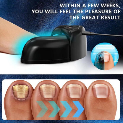 Effective Toenail Fungus Remover