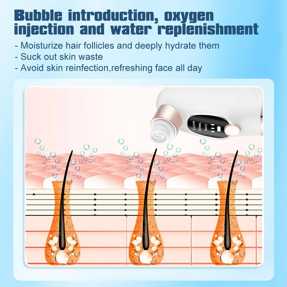 Portable Blackhead Remover Vacuum Cleaner