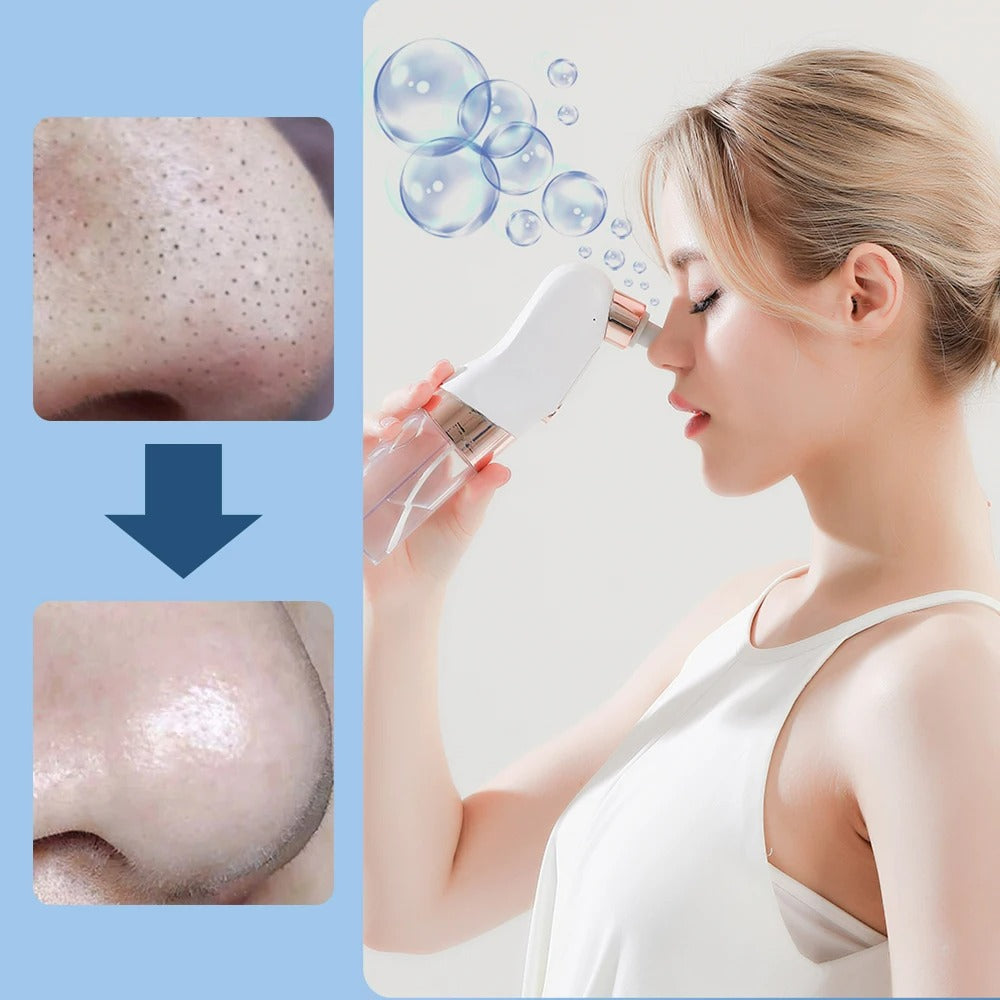 Portable Blackhead Remover Vacuum Cleaner