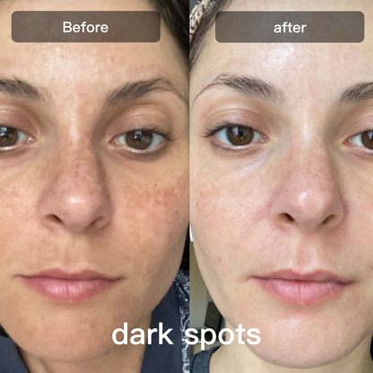 Advanced 7 Color LED Skin Care Device